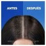 Champô Head & Shoulders S Anticaída 1 L | Epamu | Beauty Shop - Parfums, Make-up & Essentials Epamu.eu